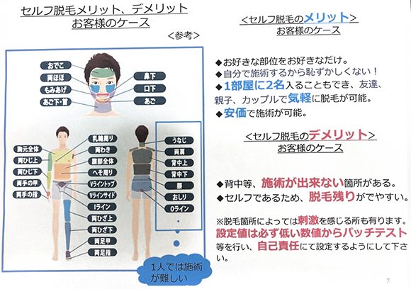 セルフ脱毛とは？
